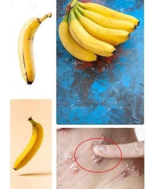 Did you know that if you eat BANANA EVERY DAY your body can..